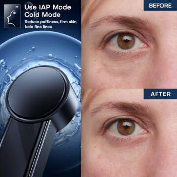 Radio Frequency Skin Tighter | Smart-Electric | Face Lifter | Firm | Contour | Massage - at Home Skin Care for Collagen Increase Wrinkle Reduction - Rechargable RF Face Beauty Device (Gold Black)