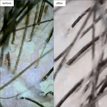 Briogeo Scalp Revival Megastrength Dandruff Shampoo, Charcoal + AHA/BHA with Salicylic Acid 3%, Anti-Dandruff Shampoo to Soothe a Dry, Flaky, Itchy Scalp, Vegan, Cruelty-Free, 8.4 fl oz