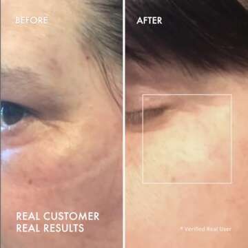 depology Restoring Hydrogel Under Eye Patch | 60 Patches | Brightening Caffeine Gold Pads for Dark Circles | Puffiness | Wrinkles | Refresh | Travel