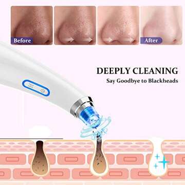 Blackhead Remover Vacuum - USB Rechargeable Blackhead Suction Device with 4 Adjustable Suction Levels and 4 Removable Probes - Pore Vacuum Suction Acne Extractor for All Skin Types