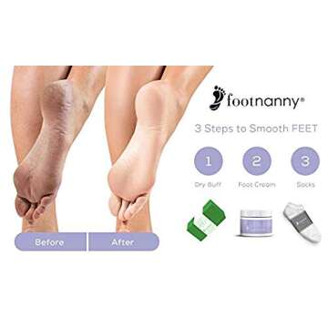 Footnanny Mini Peppermint Foot Cream – Travel Relief for Cracked Heels!