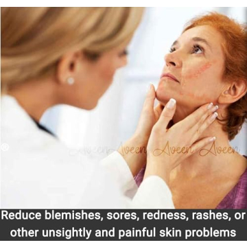 Comfortable CPAP Strap Covers for Better Sleep Therapy