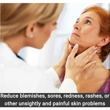 Comfortable CPAP Strap Covers for Better Sleep Therapy