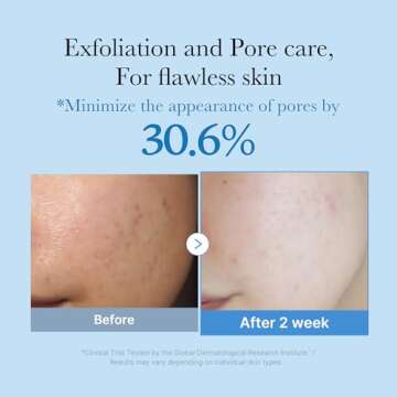 medicube Zero Pore Toner I Exfoliating & Hydrating Blue Bottle Water Toner with AHA, BHA, PHA, Niaci...