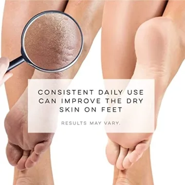 LE EMILIE Moisturizing Gel Heel Socks | Perfect Gift for Healing Dry Cracked Heels and Feet | Infused with Aromatherapy Blend of Lavender and Jojoba Oil | 1 Pair, PINK