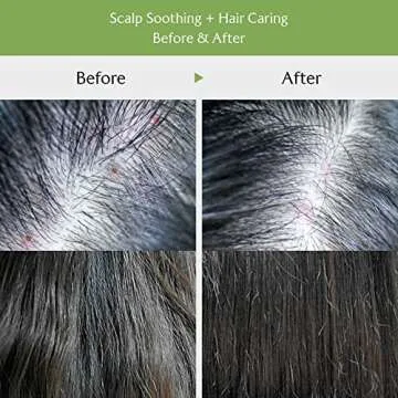 LA'DOR Hair Conditioner - Tea Tree Scalp Clinic Hair Pack, 6.76 Fl Oz - Calming & Nourishing with Snail Mucin, Green Tea, Aloe for Itchy Sensitive Dry Flaky Damaged Scalp