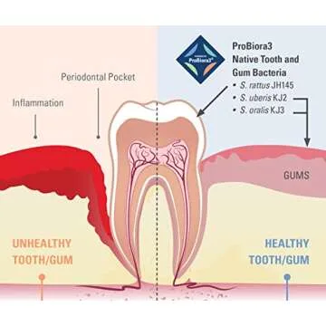 ProBiora Oral-Care Chewable Probiotic Tablets | Probiotic Supplement for Women & Men | Healthier Teeth & Gums | Fresher Breath | Whiter Teeth | 60 Count | Mint