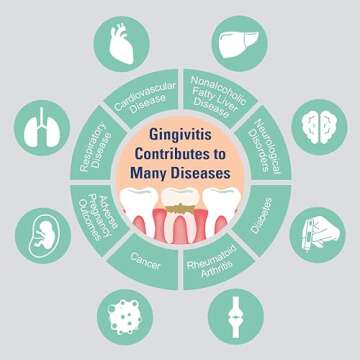 ProBiora Oral-Care Chewable Probiotic Tablets | Probiotic Supplement for Women & Men | Healthier Teeth & Gums | Fresher Breath | Whiter Teeth | 60 Count | Mint