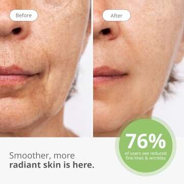 Tria Age-Defying SmoothBeauty Laser for Youthful Skin