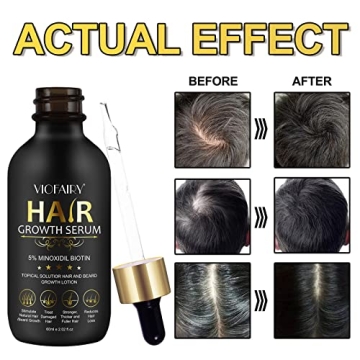 PEFAMNE 5% Minoxidil Hair Growth Oil for Thicker Healthier Hair