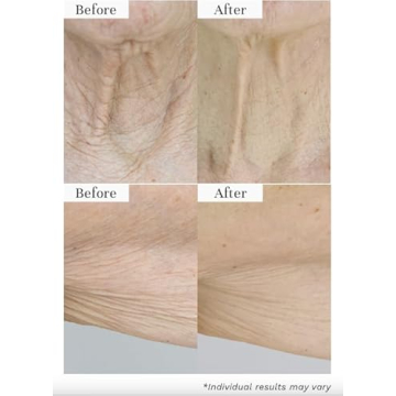 City Beauty InvisiCrepe Body Balm for Firm Skin Care