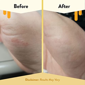 Eczema Honey Cooling Face & Body Rounds - 50 Cotton Pads