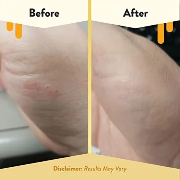 Eczema Honey Cooling Face & Body Rounds - 50 Cotton Pads