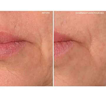 SiO Beauty Super LipLift - Smile & Lip Anti-Wrinkle Patches 4 Week Supply - Overnight Smoothing Sili...