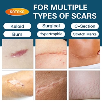 Medical Grade Silicone Scar Sheets for Effective Healing