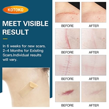 Medical Grade Silicone Scar Sheets for Effective Healing