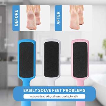 Fu Store Pedicure Foot Files Callus Remover Set for Smooth Feet