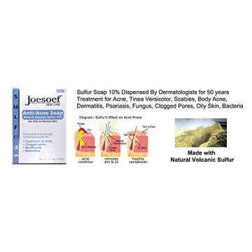 Joesoef Anti-Acne Soap, Natural Volcanic Sulfur 10%, for Oily to Normal Skin, 3.5-Ounces (Pack of 3)