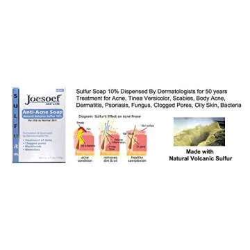 Joesoef Anti-Acne Soap, Natural Volcanic Sulfur 10%, for Oily to Normal Skin, 3.5-Ounces (Pack of 3)