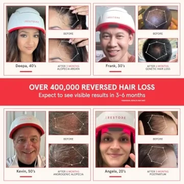 iRestore Professional Hair Growth System - FDA Cleared