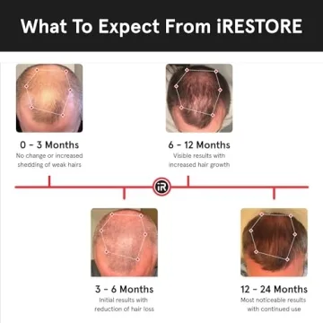 iRestore Professional Hair Growth System - FDA Cleared