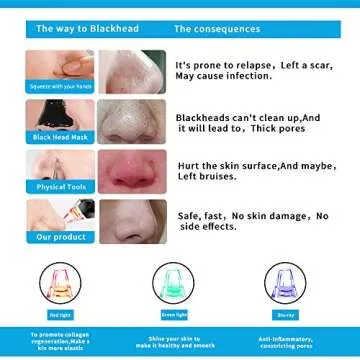 Blackhead Remover Pore Vacuum Pimple Comedone Extractor USB Rechargeable Blackhead Pore Sucker Vacuum Removal Cleaning Tool 3-Color Beauty Lamp 5 Adjustable Suction Power with 4 Replaceable Suction Pr