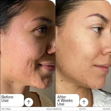 Retinal Niacinamide Serum for Anti-Aging & Brightening