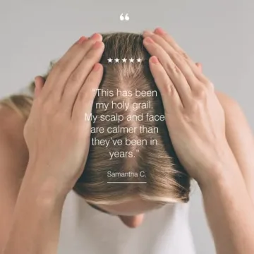 Dermazen Shampoo for Dandruff Relief and Scalp Care Overview