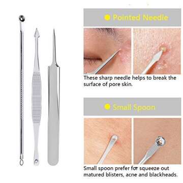 Aooeou Blackhead Remover Tool Kit - 10 in 1 Stainless Steel