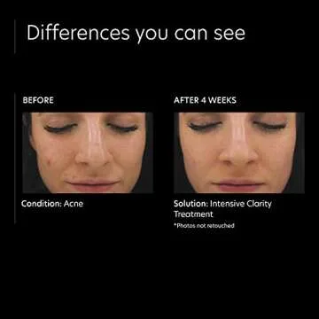 PCA SKIN Intensive Clarity Treatment for Breakouts