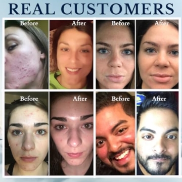 Gentle Rosemary Face Wash - Organic Cleansing for All Skin Types