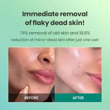 Dr.G Korean Derma Peeling Gel for All Skin Types - 120ml