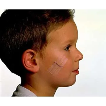 Nexcare Steri-Strip Wound Closure for Wound Care Needs