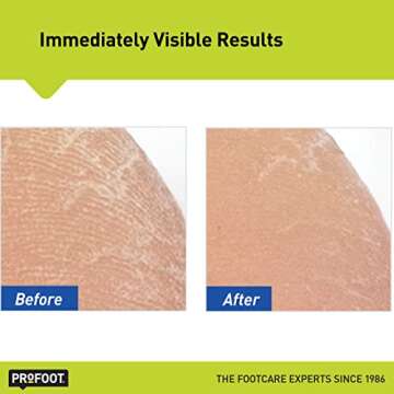 Profoot Heel Rescue Foot Cream 16 Ounce Bottle, 2 Pack, for Cracked, Calloused or Chapped Skin