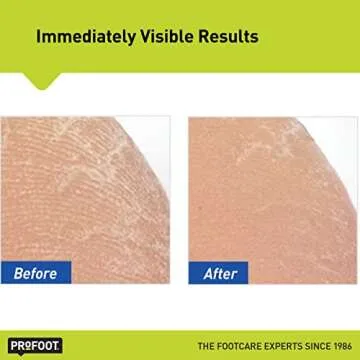 Profoot Heel Rescue Foot Cream 16 Ounce Bottle, 2 Pack, for Cracked, Calloused or Chapped Skin