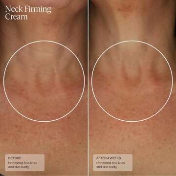 Sente Neck Firming Cream - Advanced Anti-Aging Firming and Lift Cream with Patented HSA, Caffeine and Vitamin C - 1.7 Oz