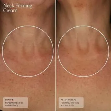 Sente Neck Firming Cream - Advanced Anti-Aging Firming and Lift Cream with Patented HSA, Caffeine and Vitamin C - 1.7 Oz