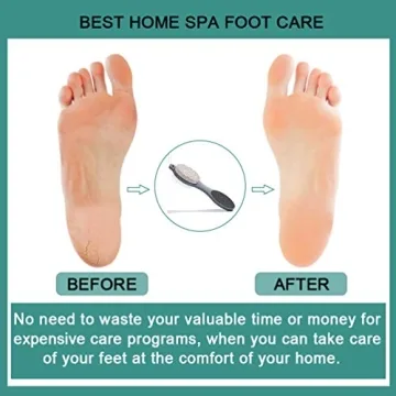 CAREHOOD 4 in 1 Foot Pedicure Tool for Perfect Feet