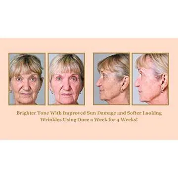 Bee Stunning DIAMONDBUFF Microderm Exfoliation Tool for at Home Glowing and Radiant Skin | Reduce Acne, Fine Lines, Wrinkles, & Provide a Velvety Smooth Complexion with Diamond Microdermabrasion