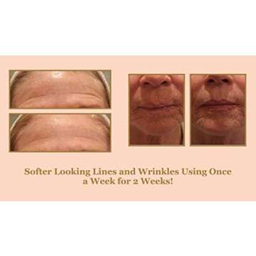 Bee Stunning DIAMONDBUFF Microderm Exfoliation Tool for at Home Glowing and Radiant Skin | Reduce Acne, Fine Lines, Wrinkles, & Provide a Velvety Smooth Complexion with Diamond Microdermabrasion