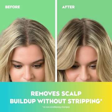 OGX Extra Strength Refreshing Scalp + Teatree Mint , Invigorating Scalp Shampoo with Tea Tree & Pepp...