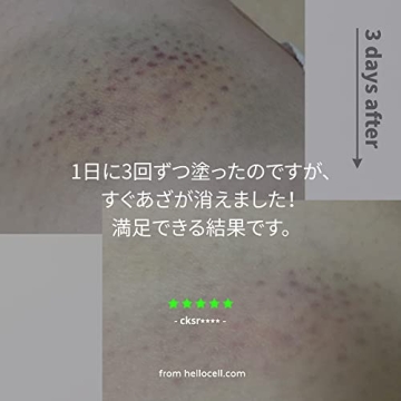 Hellocell Vitamin K Cream for Dark Circles and Bruising