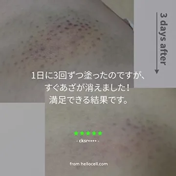 Hellocell Vitamin K Cream for Dark Circles and Bruising