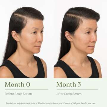 Divi Scalp Serum for Thinning Hair – Nourishing & Tested