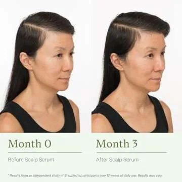 Divi Scalp Serum for Thinning Hair – Nourishing & Tested