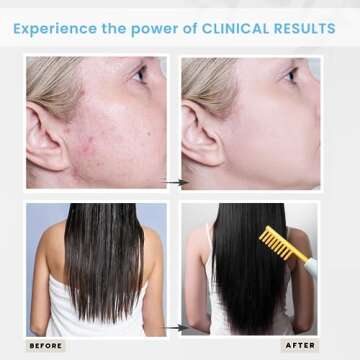 DermatiPrem High Frequency Wand