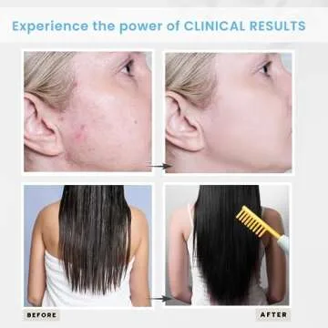 DermatiPrem High Frequency Wand