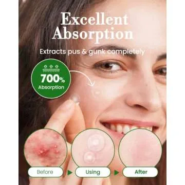 Hydrocolloid Acne Patches for Clear Skin Solutions