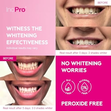InoPro Teeth Whitening Strips Enamel Safe 14 Treatments Kit