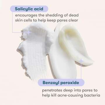 Proactiv 3 Step Advanced Skincare Acne Treatment Benzoyl Peroxide Face Wash, Salicylic Acid Exfoliator for Pore Minimizer, 30 Day Complete Kit, White, 3 Count